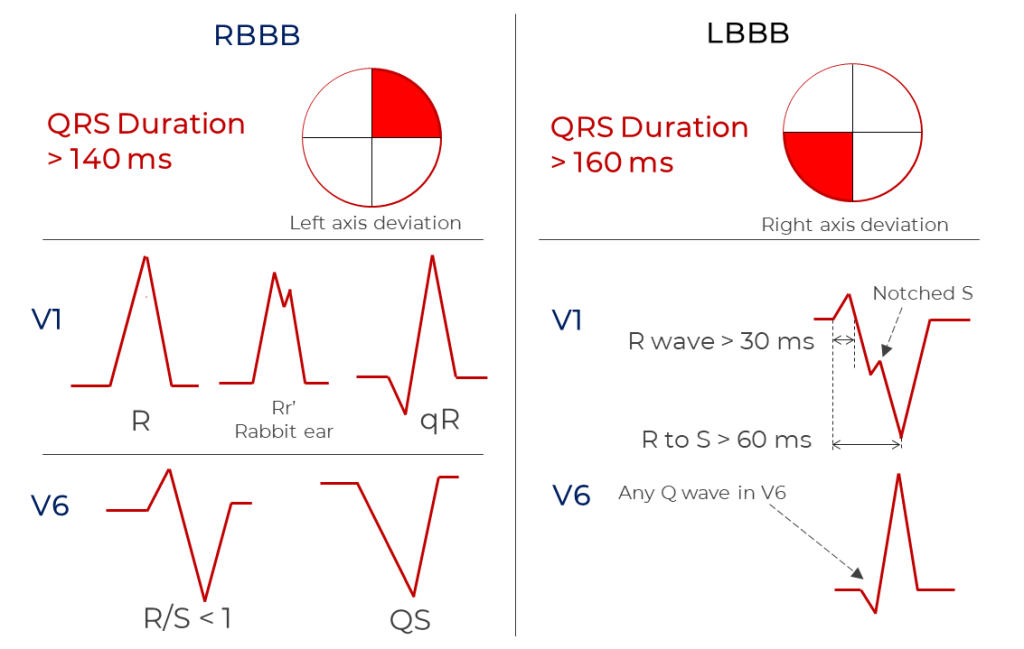 Classical Criteria summary