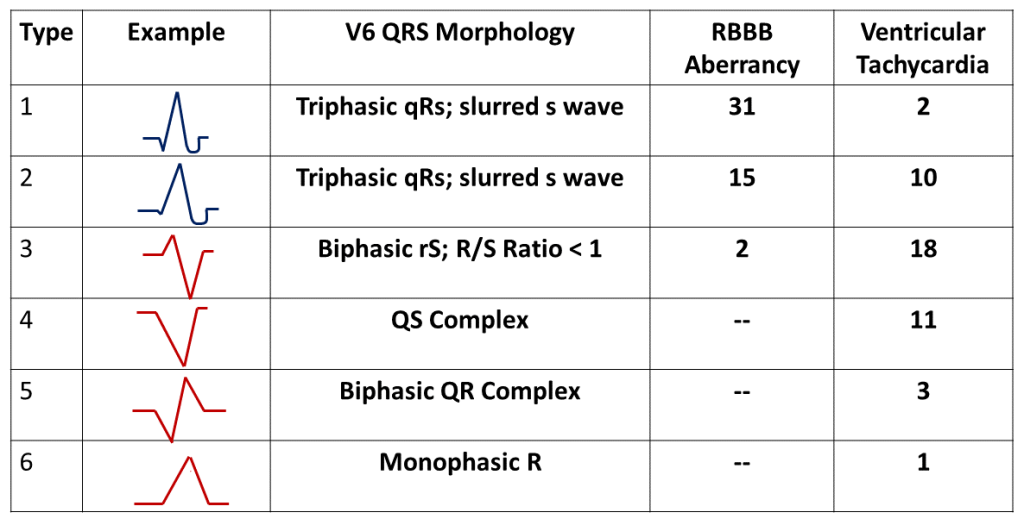 Table 4. Configuration of Right Bundle Branch Block-Shaped QRS Complexes in Lead V6